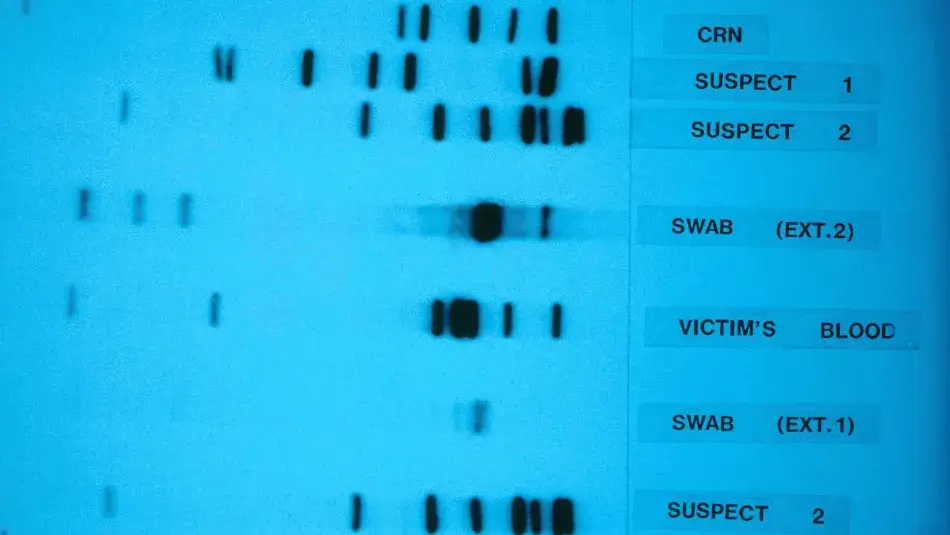 DNA sequencing gel